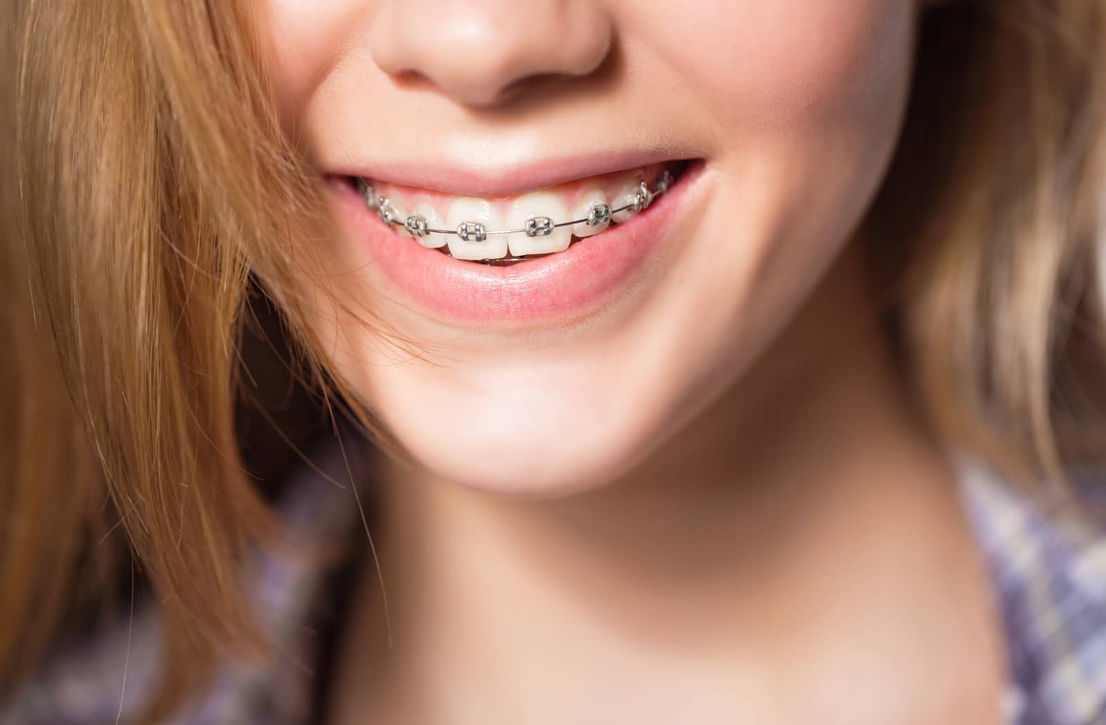 The Difference Between Invisalign & Braces
