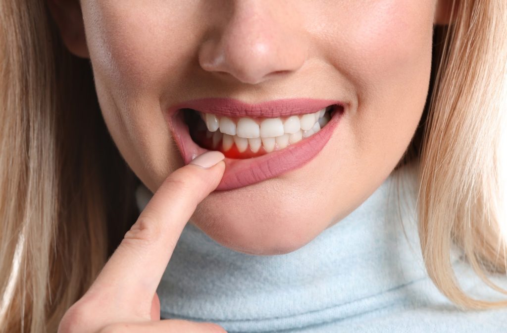 Close up of woman with gum inflammation