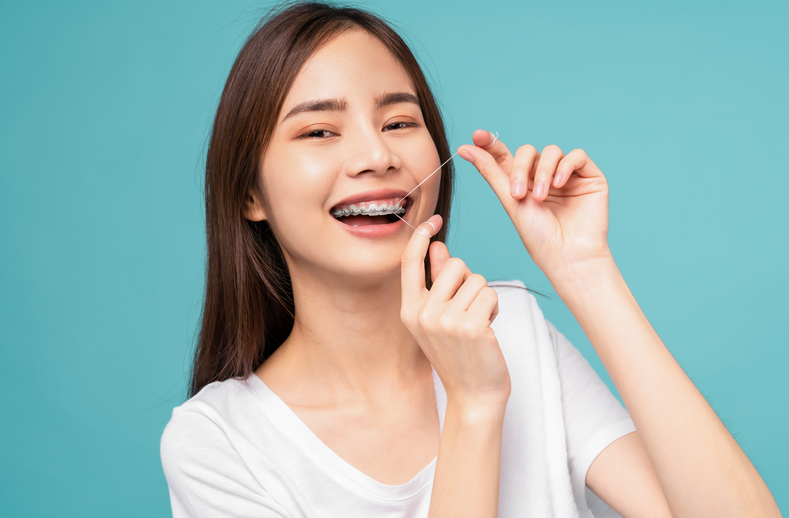 How Do I Floss With Braces? | Calgary, AB | Shawnessy Dental