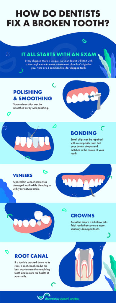 An infographic about how dentists can fix a broken tooth including polishing, bonding, veneers, crowns, and a root canal.