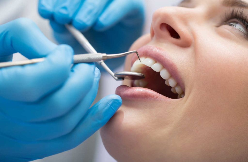 A close up of a patient's mouth during a regular dental exam and cleaning.