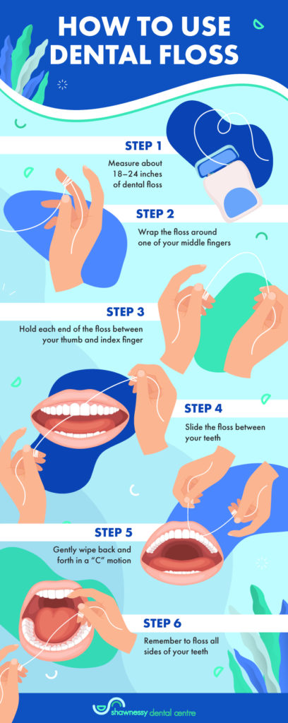 How Often Should You Floss | Calgary | Shawnessy Dental