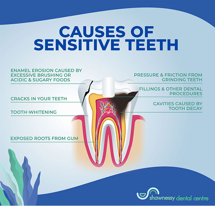 An infographic showing the various causes of sensitive teeth and how they affect the different parts of the tooth.
