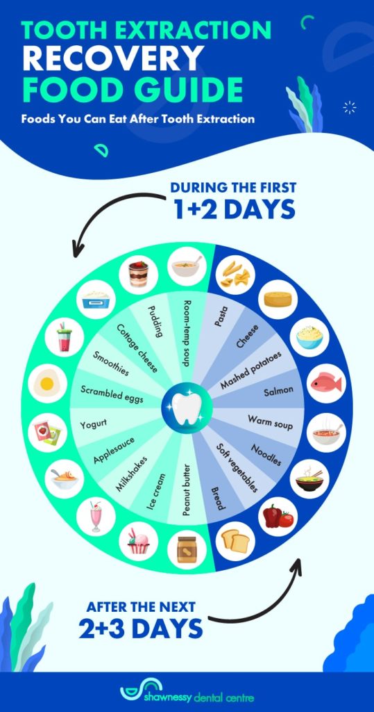 Food guide for what to eat after tooth extraction.