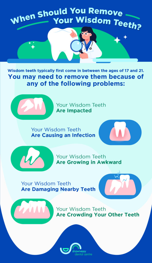 A detailed infographic explaining when you should remove your wisdom teeth.