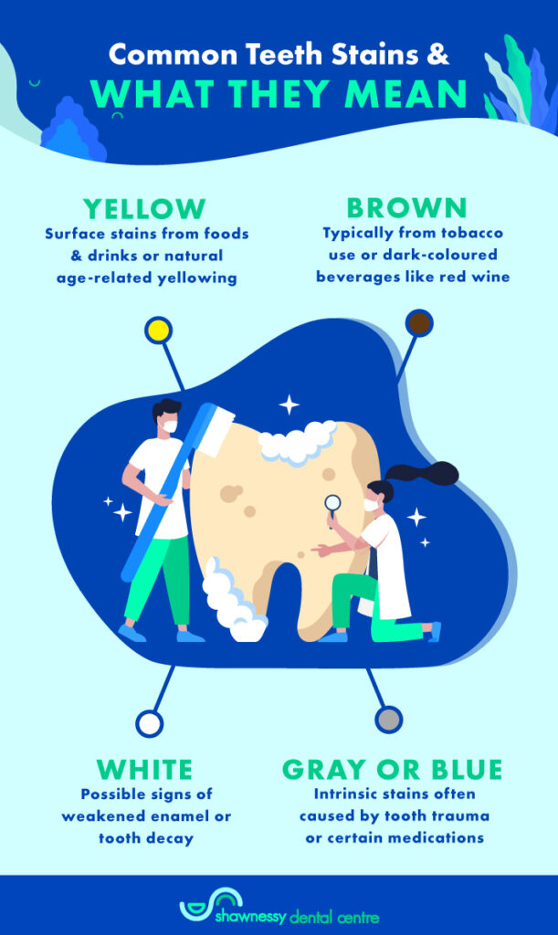 An infographic showing common types of teeth stains