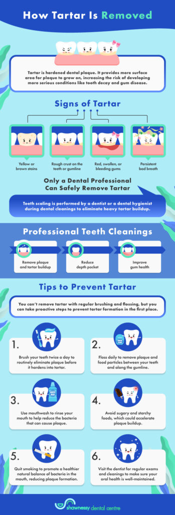 An infographic highlighting the signs of tartar and how to remove it. 