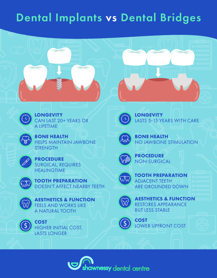 Graphic comparing the differences between a dental implant and dental bridge.