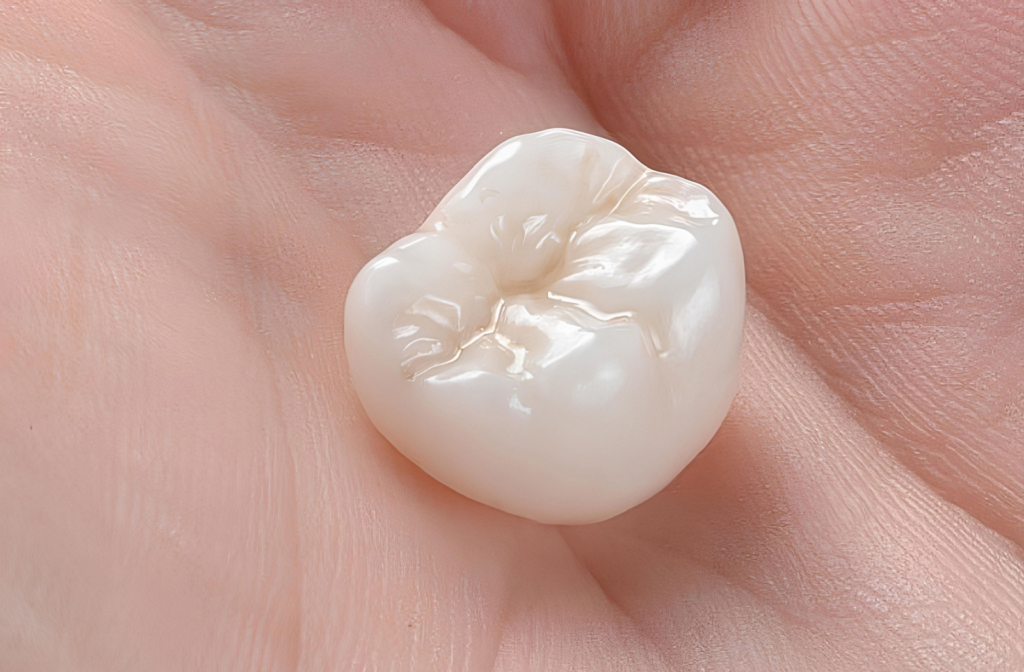 Close up of a dental crown in the palm of a person's hand